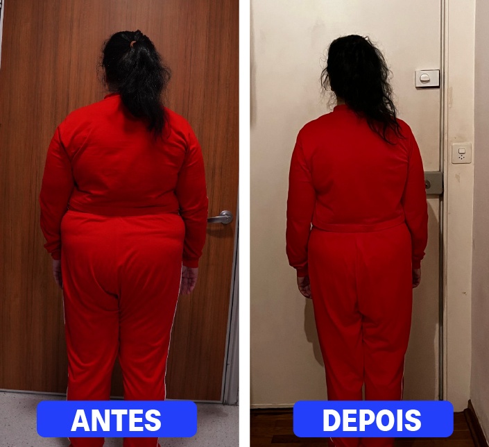 1_Cirurgia Bariátrica 2