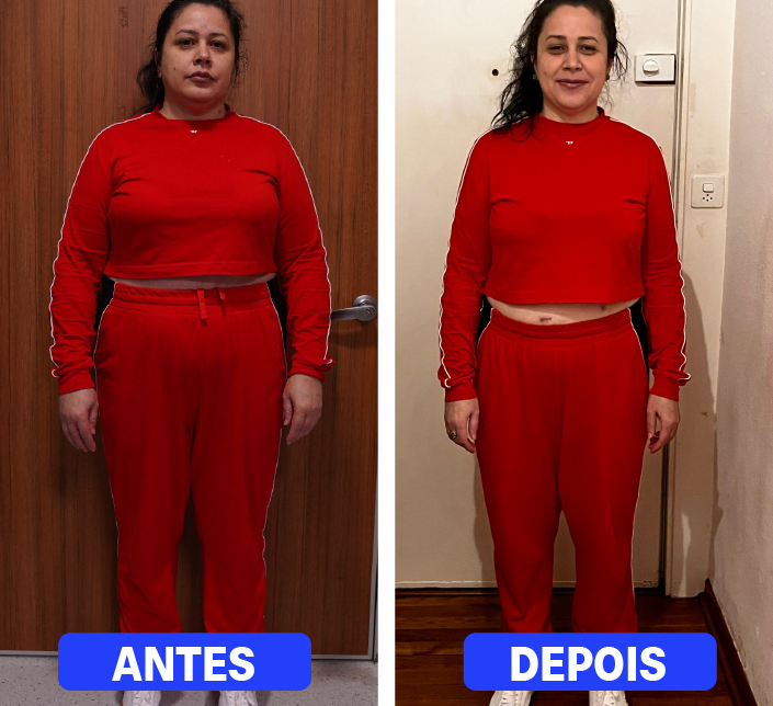 1_Cirurgia Bariátrica 3