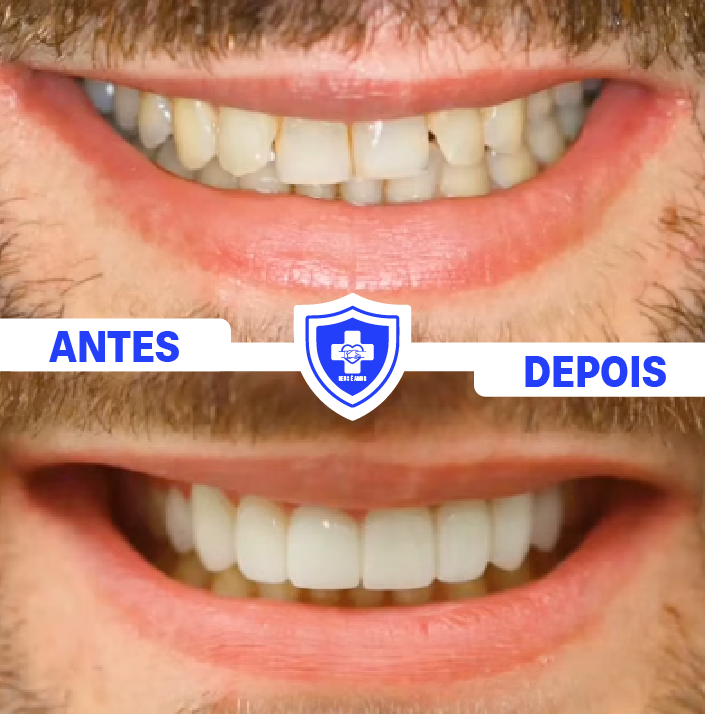 1_Tratamento Dentário 5