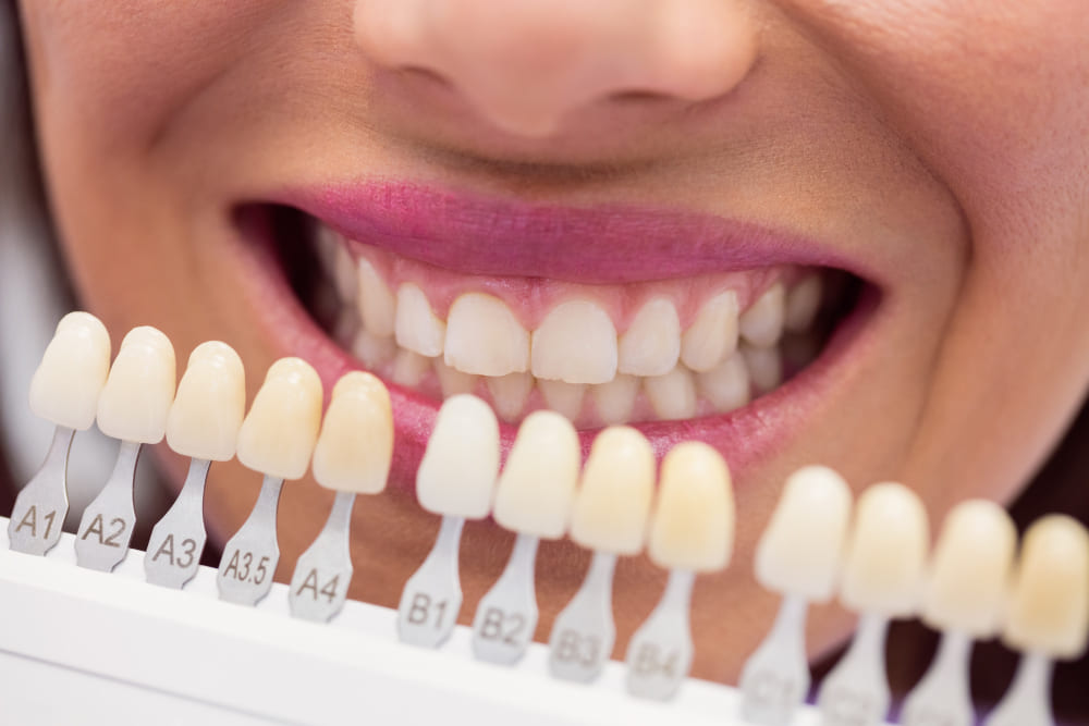 ESTÉTICA DENTÁRIA E DESIGN DO SORRISO