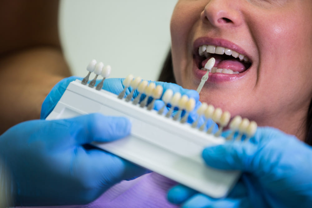 IMPLANTE DENTÁRIO