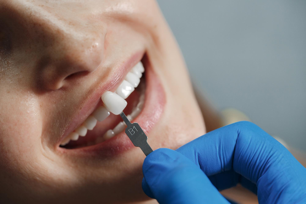 Tratamento Dentário
